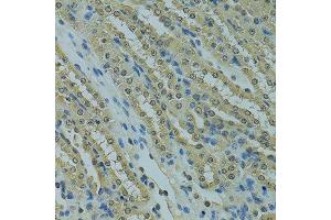 Immunohistochemistry of paraffin-embedded mouse kidney using UBE2I antibody.