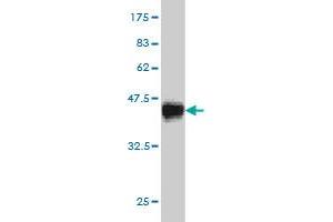 Western Blot detection against Immunogen (35. (CDK8 anticorps  (AA 375-464))