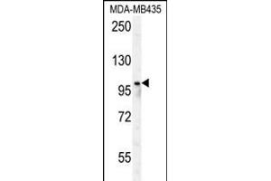 RP8 Antibody (Center) (ABIN650978 and ABIN2840019) western blot analysis in MDA-M cell line lysates (35 μg/lane). (PARP8 anticorps  (AA 632-660))