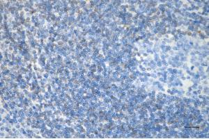 Immunohistochemistry was performed on paraffin-embedded human tonsillitis using bcl-2 antibody (ABIN7797719), 1:200). (Recombinant Bcl-2 anticorps)