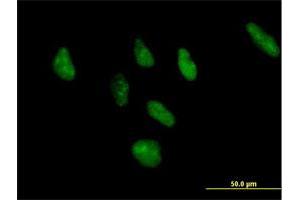 Immunofluorescence of purified MaxPab antibody to ZNF346 on HeLa cell. (ZNF346 anticorps  (AA 1-294))