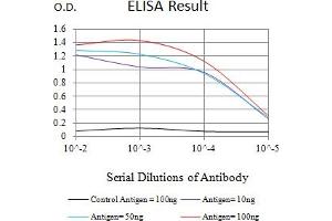 Black line: Control Antigen (100 ng),Purple line: Antigen (10 ng), Blue line: Antigen (50 ng), Red line:Antigen (100 ng)