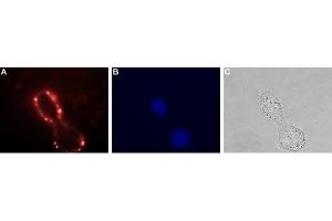 Expression of VPAC1 in human HT-29 cells - Cell surface detection of VPAC1 in live intact human HT-29 colorectal adenocarcinoma cells.
