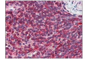 Immunohistochemistry (IHC) image for anti-Phosphatidylinositol-5-Phosphate 4-Kinase, Type II, alpha (PIP4K2A) (AA 304-366) antibody (ABIN782432)
