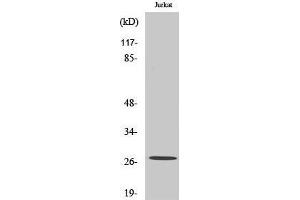 Western Blotting (WB) image for anti-Potassium Large Conductance Calcium-Activated Channel, Subfamily M, beta Member 2 (KCNMB2) (Internal Region) antibody (ABIN3175931) (KCNMB2 anticorps  (Internal Region))