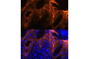 Immunofluorescence analysis of human skin using SPRR1A antibody (ABIN7270369) at dilution of 1:100.