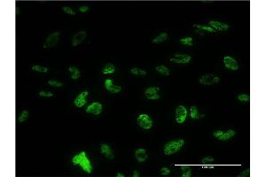 Immunofluorescence of monoclonal antibody to PUF60 on HeLa cell. (PUF60 anticorps  (AA 1-516))