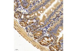 Immunohistochemistry of paraffin embedded mouse duodenum using TAF4 (ABIN7075827) at dilution of 1:450 (400x lens) (TAF4 anticorps)