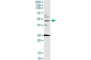 FOXF2 monoclonal antibody (M08), clone 3D11. (FOXF2 anticorps  (AA 346-443))