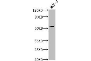 Western Blot Positive WB detected in: MCF-7 whole cell lysate All lanes: PPM1J antibody at 1:2000 Secondary Goat polyclonal to rabbit IgG at 1/50000 dilution Predicted band size: 55, 34 kDa Observed band size: 55 kDa (PPM1J anticorps  (AA 294-505))
