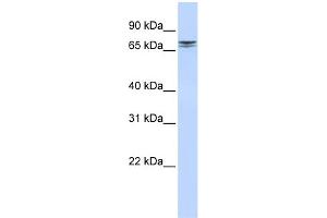 WB Suggested Anti-NCAPH2 Antibody Titration: 0. (NCAPH2 anticorps  (N-Term))