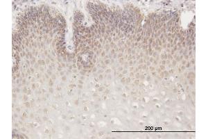Immunoperoxidase of purified MaxPab antibody to RGS13 on formalin-fixed paraffin-embedded human esophagus.