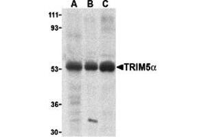 Western Blotting (WB) image for anti-Tripartite Motif Containing 5 (TRIM5) (Middle Region 1) antibody (ABIN1031194) (TRIM5 anticorps  (Middle Region 1))
