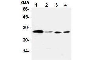 Western Blotting (WB) image for anti-B-Cell CLL/lymphoma 2 (BCL2) antibody (ABIN1105506)