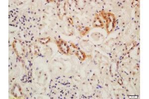 Formalin-fixed and paraffin embedded mouse kidney labeled with Rabbit Anti-ATG13 Polyclonal Antibody, Unconjugated  at 1:200 followed by conjugation to the secondary antibody and DAB staining (ATG13 anticorps  (AA 51-150))