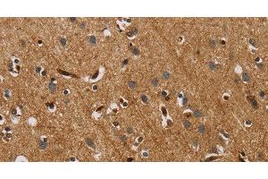 Immunohistochemistry of paraffin-embedded Human brain tissue using IL18R1 Polyclonal Antibody at dilution 1:40 (IL18R1 anticorps)