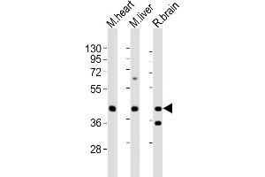 All lanes : Anti-P2ry4 Antibody (N-term) at 1:2000 dilution Lane 1: mouse heart lysates Lane 2: mouse liver lysates Lane 3: rat brain lysates Lysates/proteins at 20 μg per lane.