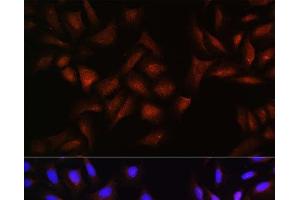 Immunofluorescence analysis of U-2 OS cells using BTRC Polyclonal Antibody at dilution of 1:100. (BTRC anticorps)