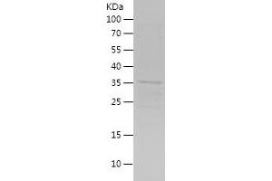 Western Blotting (WB) image for SIX Homeobox 2 (SIX2) (AA 146-291) protein (His-IF2DI Tag) (ABIN7125111)