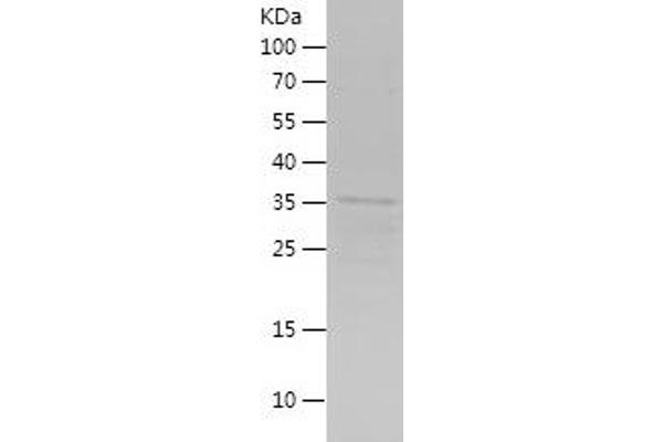 SIX2 Protein (AA 146-291) (His-IF2DI Tag)