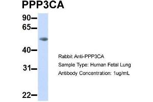 Host:  Rabbit  Target Name:  PPP3CA  Sample Type:  Human Fetal Lung  Antibody Dilution:  1.