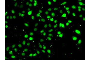 Immunofluorescence analysis of HeLa cells using NUDT2 antibody. (NUDT2 anticorps)