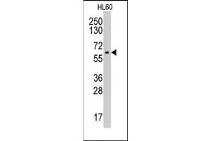 AP14030PU-N CYP19A1 antibody staining of HL60 cell line lysates by Western blot (35 µg/lane). (Aromatase anticorps  (Middle Region))