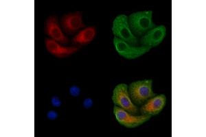 ABIN6257649 and ABIN6275602 staining Hela cells by IF/ICC. (Sorting Nexin 4 anticorps  (Internal Region))