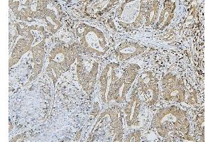 IHC analysis of ApoER2/LRP8 using anti-ApoER2/LRP8 antibody (ABIN7601752).