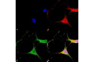 Immunocytochemistry/Immunofluorescence analysis using Mouse Anti-Kir6.