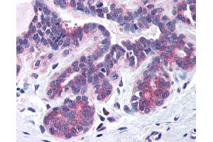 Anti-SNX16 antibody IHC of human breast. (SNX16 anticorps  (AA 2-14))