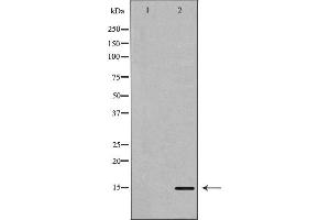 Western blot analysis of extracts of Mouse brain tissue lysate, using KISS1antibody. (KISS1 anticorps  (Internal Region))
