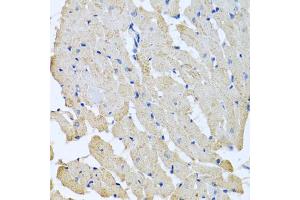 Immunohistochemistry of paraffin-embedded rat heart using GPLD1 antibody (ABIN5973975) at dilution of 1/100 (40x lens). (GPLD1 anticorps)