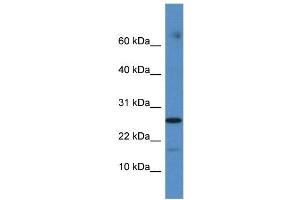 FAM36A antibody used at 1 ug/ml to detect target protein. (FAM36A anticorps  (Middle Region))
