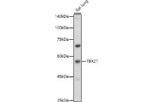 Western blot analysis of extracts of Rat lung, using TBX21 antibody (ABIN1682974, ABIN3019139, ABIN3019140 and ABIN6220736) at 1:500 dilution. (T-Bet anticorps  (AA 326-535))