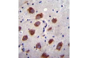 BR1B Antibody (Center) (ABIN655973 and ABIN2845358) immunohistochemistry analysis in formalin fixed and paraffin embedded human brain tissue followed by peroxidase conjugation of the secondary antibody and DAB staining. (BMPR1B anticorps  (AA 134-162))