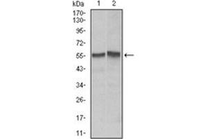 Western Blotting (WB) image for anti-TNF Receptor Superfamily, Member 6 (FAS) antibody (ABIN1106617) (FAS anticorps)