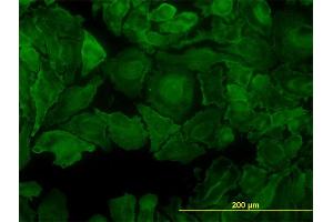 Immunofluorescence of monoclonal antibody to PTK7 on HeLa cell.