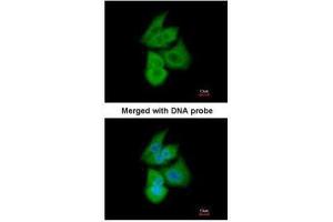 ICC/IF Image Immunofluorescence analysis of paraformaldehyde-fixed A549, using PFKL, antibody at 1:200 dilution.