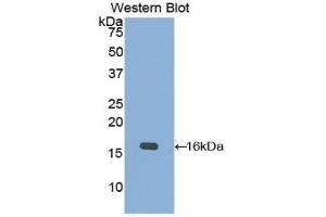 Western Blotting (WB) image for anti-Keratin 15 (KRT15) (AA 274-399) antibody (ABIN1859574) (KRT15 anticorps  (AA 274-399))