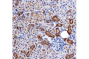IHC analysis of IMPDH2 using anti-IMPDH2 antibody (ABIN7603063).