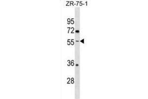 Western Blotting (WB) image for anti-Ectonucleoside Triphosphate diphosphohydrolase 5 (ENTPD5) antibody (ABIN3000843) (ENTPD5 anticorps)