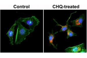 ICC staining of human HeLa cells untreated or treated with chloroquine (CHQ), with recombinant LC3B antibody (red) at 1:200 dilution.