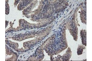 Image no. 6 for anti-PHD Finger Protein 7 (PHF7) (AA 155-381) antibody (ABIN1490975)