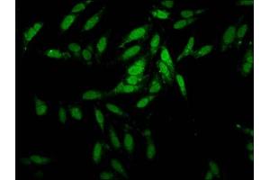 Immunofluorescence staining of Hela cells with ABIN7151937 at 1:100, counter-stained with DAPI. (ESRP2 anticorps  (AA 615-720))
