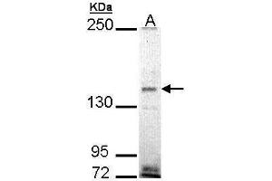 WB Image Sample (30 ug of whole cell lysate) A: H1299 5% SDS PAGE antibody diluted at 1:1000 (EHBP1 anticorps)