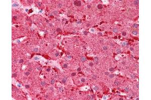 FABP1 antibody was used for immunohistochemistry at a concentration of 4-8 ug/ml.