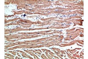 Immunohistochemical analysis of paraffin-embedded human-heart, antibody was diluted at 1:200 (NLRX1 anticorps  (AA 581-630))