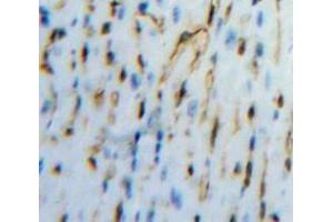Used in DAB staining on fromalin fixed paraffin-embedded Heart tissue (PCOLCE anticorps  (AA 36-468))