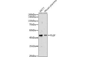 Western blot analysis of extracts of various cell lines, using PLGF antibody (ABIN7269385) at 1:500 dilution. (PLGF anticorps)